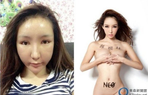 內(nèi)地嫩模做處女膜修復(fù) 拆線腫臉問可愛嗎